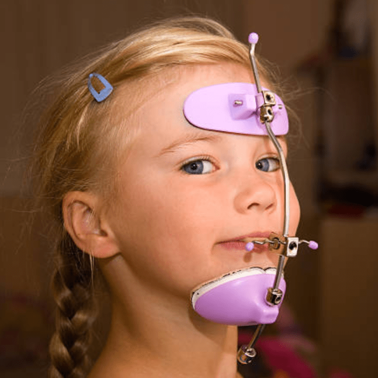 Headgear – Braces Specialist